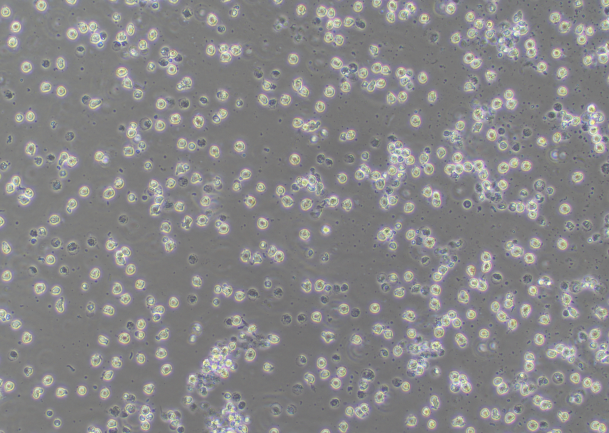 Many cell debris and dead cells observed