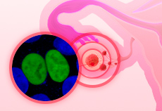ZNF432 knockout U2OS cell line helped discover drug resistance related factors of ovarian cancer