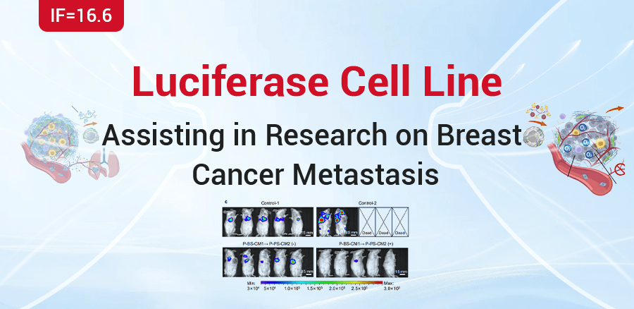 Luc Cell Aids in the Study of Disseminated Breast Cancer Metastasis