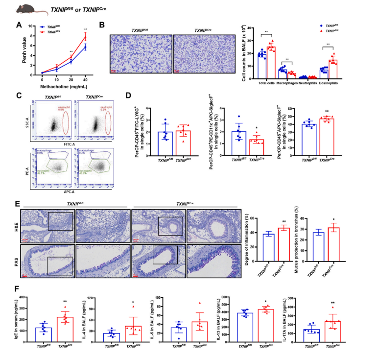 Using TXNIPCre mice to validate the role of TXNIP in asthma induction