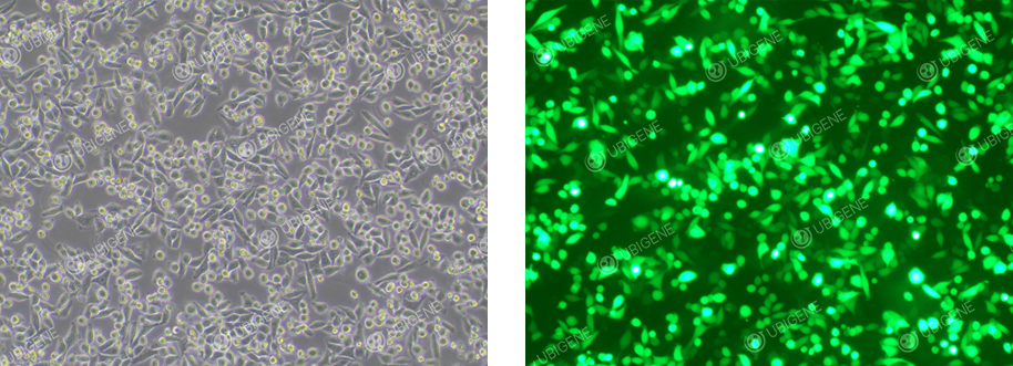 Electroporated HeLa Cells