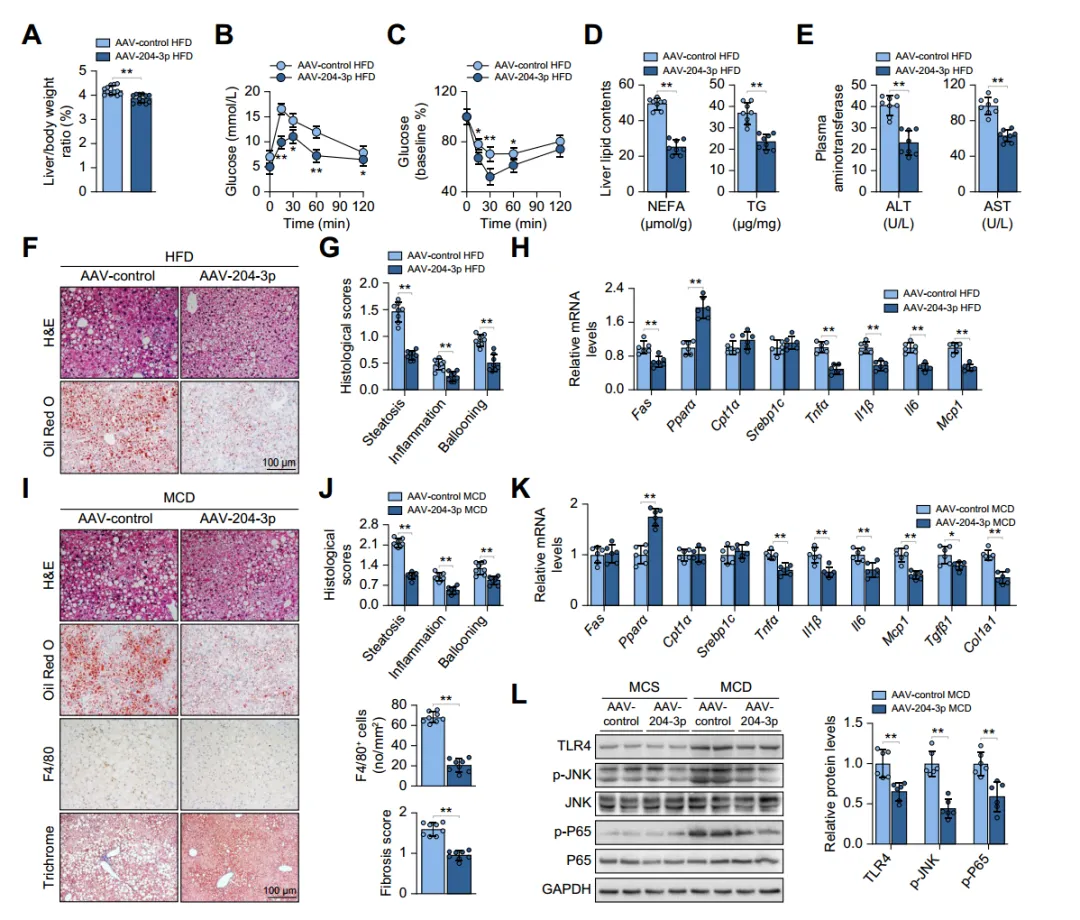 Macrophage miR-204-3p ameliorates experimental steatohepatitis in mice.