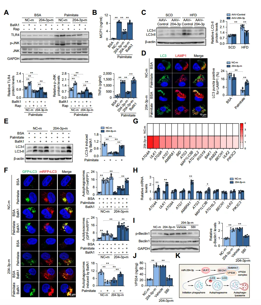 miR-204-3p inhibits macrophage inflammation by restoring ULK1-dependent autophagy.