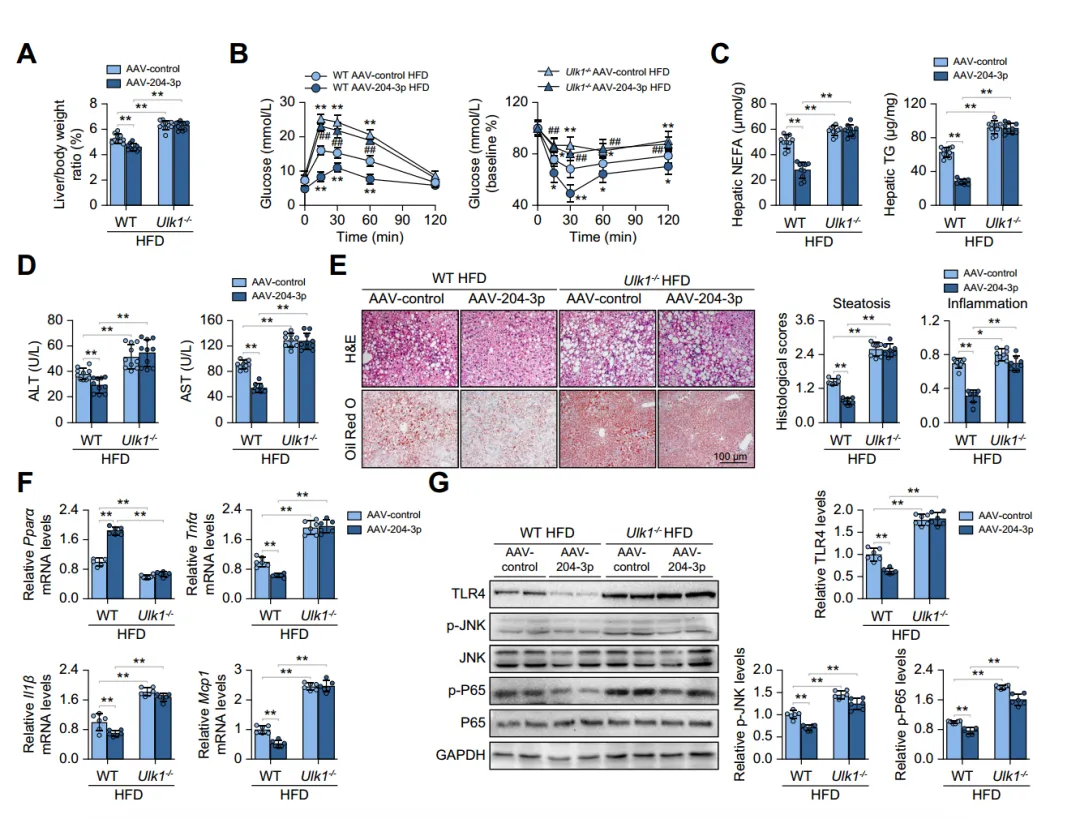 Ulk1 deficiency abolishes the protective effects of miR-204-3p on MASLD.