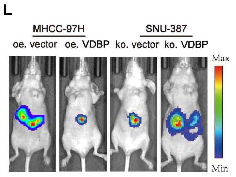 lmaging of SNU-387-Luc cell injection in mice