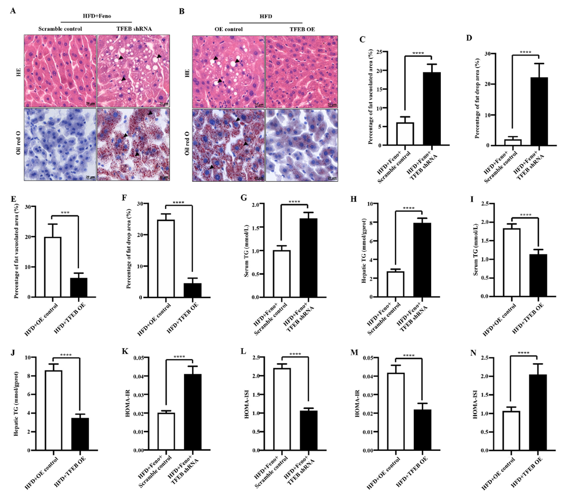 Fenofibrate improves hepatic steatosis, reduces triglyceride levels, and insulin resistance in NAFLD mice through TFEB