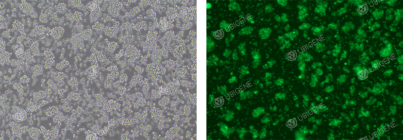 Post-infected (Lentivirus) Jurkat Cell Line