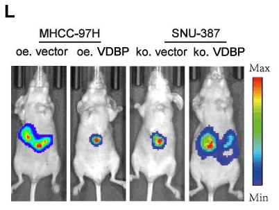 SNU-387-Luc cell injection in BALB/c mice