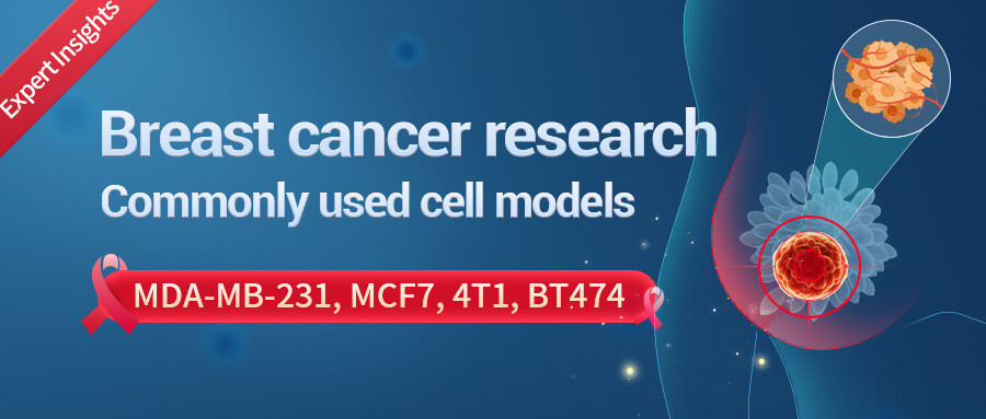 Popular Breast Cancer Cell Models