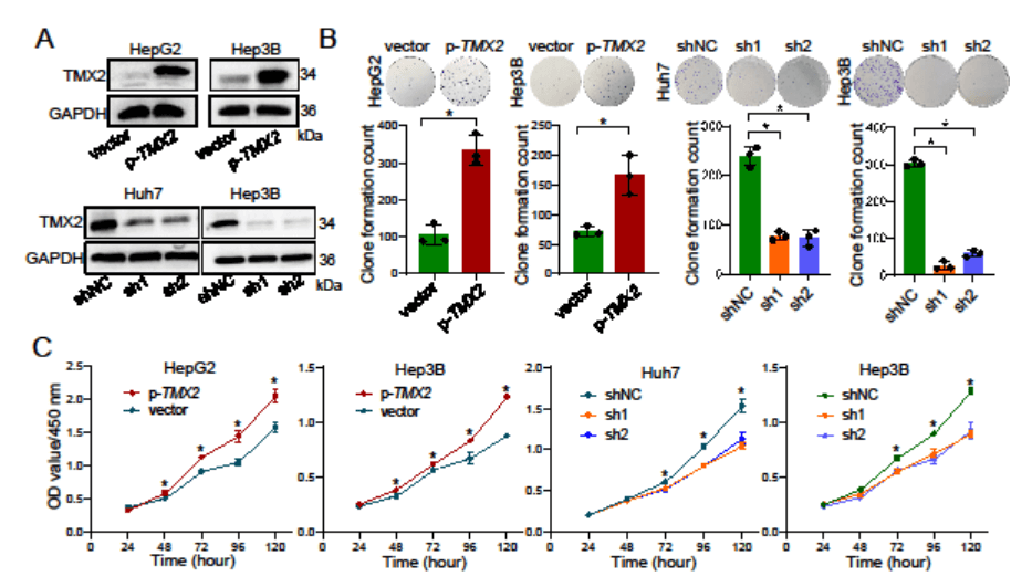 Gene knockdown or overexpression of TMX2 in different HCC cell lines