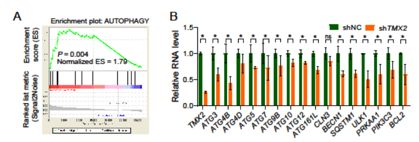 TMX2 regulates autophagy levels in HCC cells