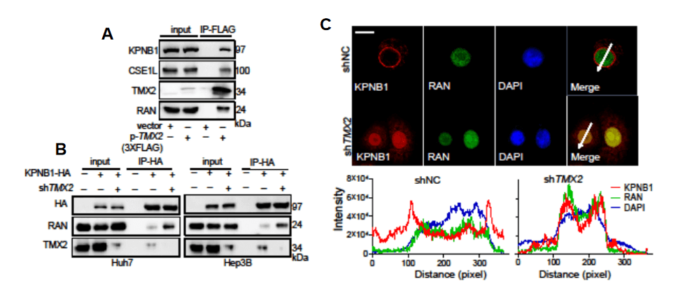 TMX2 regulates autophagy through modulation of KPNB1 nuclear-cytoplasmic distribution