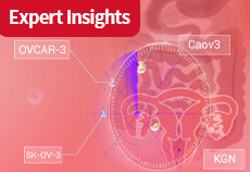 A Comprehensive Article on Commonly Used Cell Models in Ovarian Cancer Research!