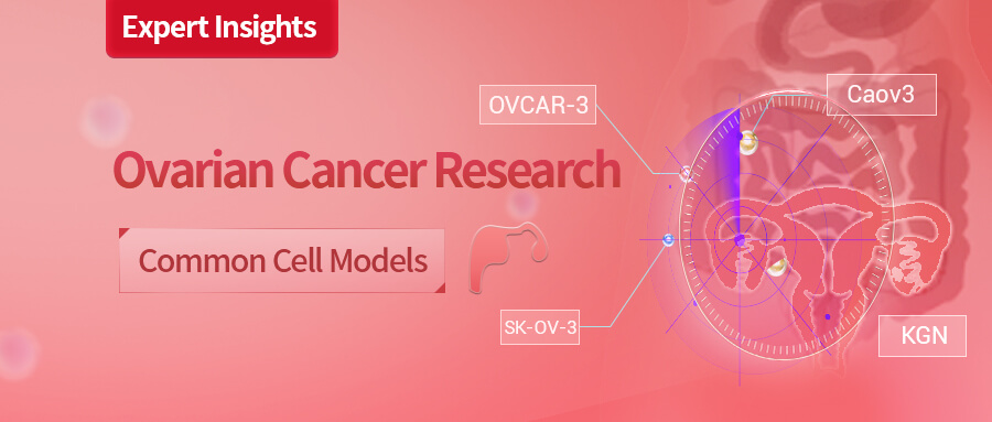 A comprehensive article on commonly used cell models in ovarian cancer research