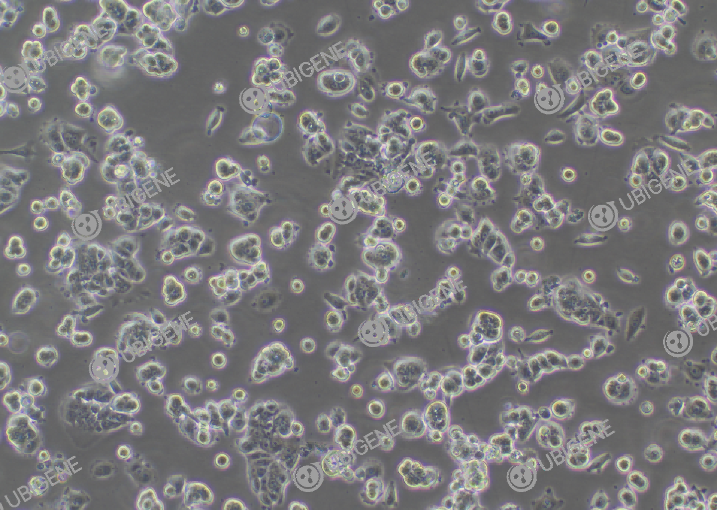 MCF7 cell line Cultured cell morphology