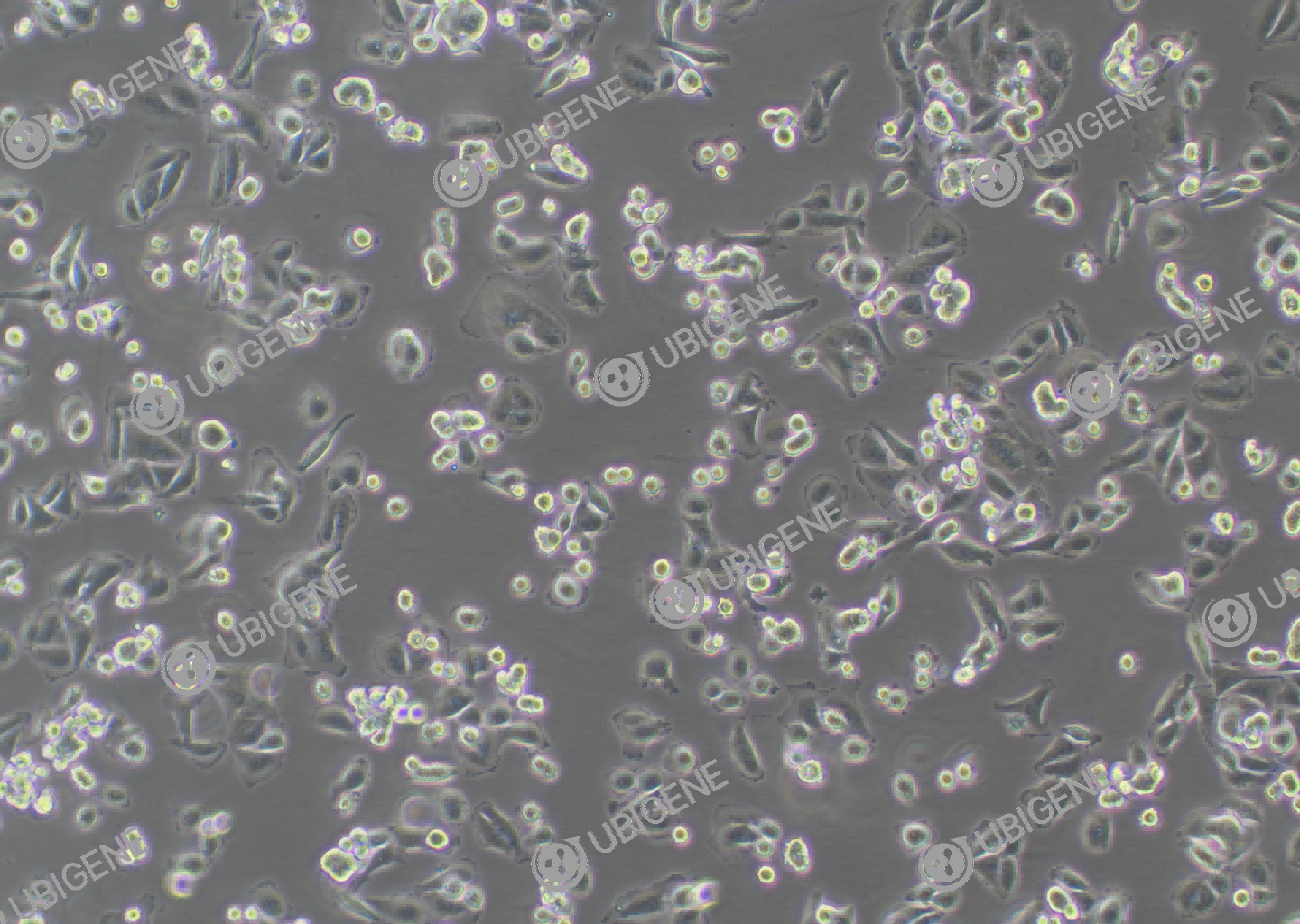 SW480 cell line Cultured cell morphology